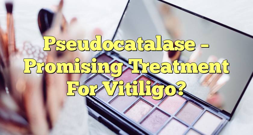 Pseudocatalase – Promising Treatment For Vitiligo?